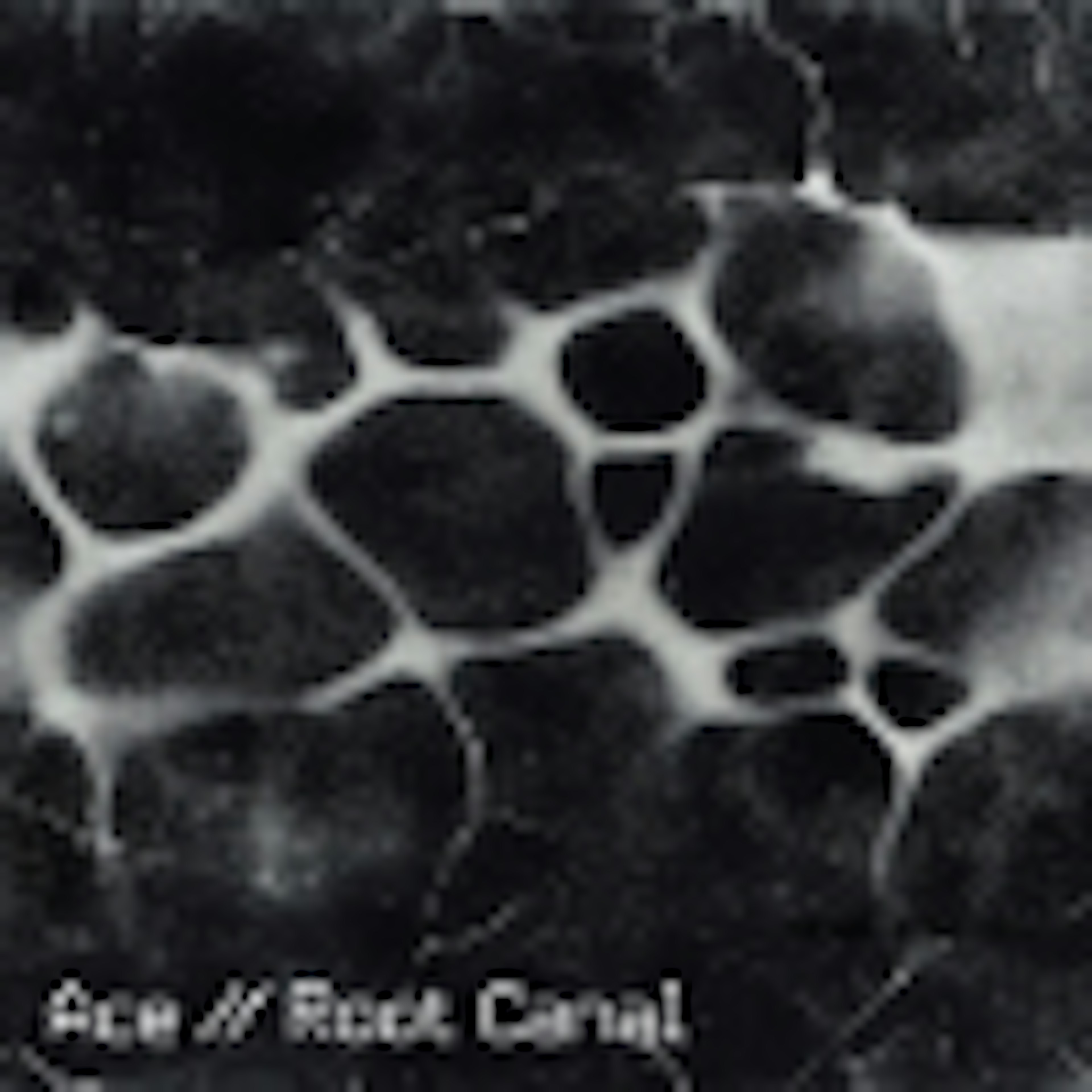 Root Canal album cover Root Canal album cover